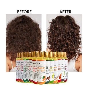 Aceite aromático nutritivo para el cuidado del cabello, relajante, relajante, masaje facial corporal, fábrica de aceites esenciales, venta al por mayor, personalizado - Product Image 5