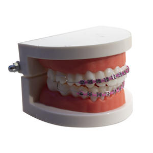 Bretelle eleganti per gioielli dentali | Decorazioni dentistiche ortodontiche alla moda per adulti e ragazzi | Accessori alla moda per il sorriso" - Product Image 2