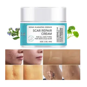 Private Label Mark Removal Cream Stretch Mark Face Body Skin Repair Treatment Old Scar Acne Burn Scar Removal Cream