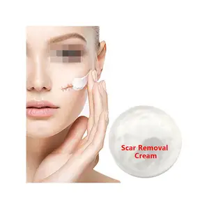 Gel para eliminar cicatrices, tratamiento para el acné, crema blanqueadora para el cuidado de las cicatrices, crema para adultos, crema facial a base de hierbas y loción, crema para vitiligo