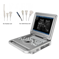 ZY-S70A Veterinärmedizinisches Schwarz-Weiß-Ultraschallscanner-System Notebook-Gerät Diagnostische 4D-Technologie CE-Zertifiziert 1 Jahr Garantie