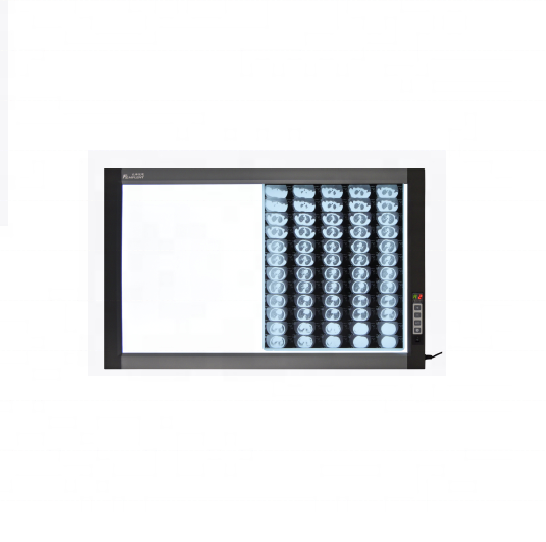 Price Reasonable Diagnosis Appliances X-ray Viewbox LED X-Ray Film Viewbox Double Screen High Brightness X-Ray Film Viewbox