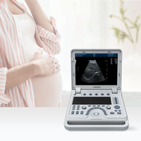 Appareil d'échocardiographie CONTEC CMS1700B Échocardiogramme Échographie Doppler couleur portable