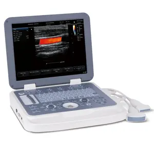 Scanner de ultrassom Doppler digital portátil avançado para Laptop