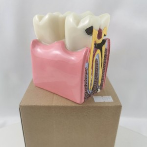 Modèle de dent à carie M4021 non amovible pour la formation et la pratique dentaire, couleur blanche, 233g, kit individuel - Product Image 5