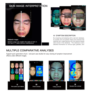 Yeni taşınabilir 3D güzellik yüz cilt analizörü ev kullanımı Salon makineleri Test cihazı yüz bakımı cilt analiz ekipmanları - Product Image 6