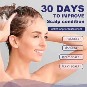 Shampooing personnalisé contre la dermatite séborrhéique shampooing antifongique pour le traitement <span class=keywords><strong>du</strong></span> <span class=keywords><strong>psoriasis</strong></span> et de la folliculite <span class=keywords><strong>du</strong></span> <span class=keywords><strong>cuir</strong></span> <span class=keywords><strong>chevelu</strong></span> - Product Image 3