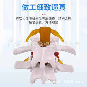Simulation pédagogique du modèle de hernie discale lombaire humaine, démonstration de mesure de la pression vertébrale, vertébral - Product Image 3