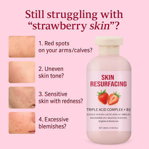 Crème Corporelle Éclat Fraise 200ml OEM Marque Privée Beurre de Karité Mangue Hydratant Végétalien Spa - Product Image 6