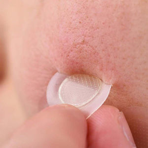 แผ่นแปะสิวไมโครดาร์ทที่ติดริ้วรอยลึกแผ่นแปะสิว9รอยกรดซาลิไซลิกที่ออกฤทธิ์เร็วรักษาจุดด่างดำ - Product Image 1