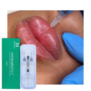 Relleno Dérmico Inyectable de Alta Calidad con Certificación CE, 2 ml, Relleno de Ácido Hialurónico para <span class=keywords><strong>Labios</strong></span> - Product Image 3