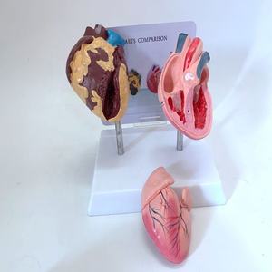 Modelo de Patología del Corazón Humano para Ciencias Médicas, Modelo de Enfermedades Orgánicas, Modelo Antidrogas - Product Image 5