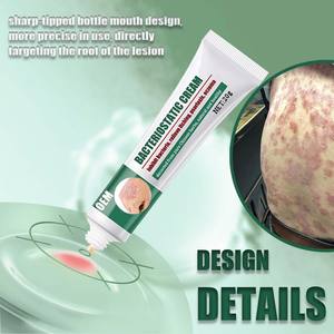 Крем для снятия псориаза для Тела облегчает зуд и устраняет покраснение - Product Image 6