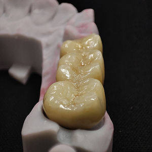 Tutti i denti di porcellana ceramica Zirconia corone impianto dentale produttore cina buon prezzo - Product Image 4