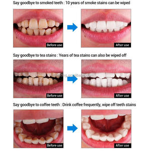 Wholesale Teeth Whitening Oral Hygiene Cleaning Serum <strong>Remove</strong> <strong>Plaque</strong> Stains Tooth Bleaching <strong>Tools</strong> Dental Care Toothpaste - Product Image 4