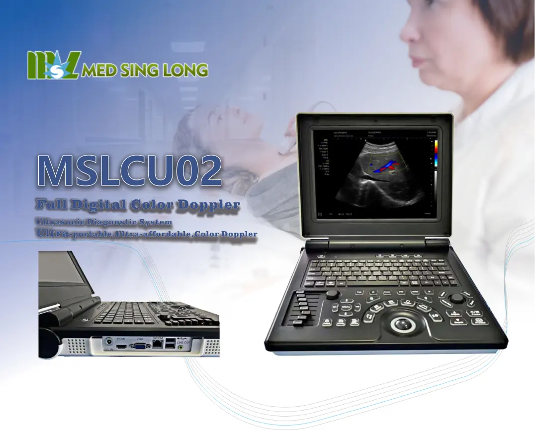 Ready To Ship 3d 4d Machine Cheapest Hot Sale Portable Color Doppler Ultrasound Machine Human Vet