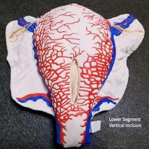 מבנה כלי דם תלת ממדי של כלי דם של היריון, חומר בד מודל עושה ברחם של חתכים מרובים - Product Image 5