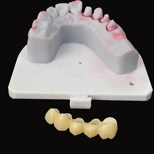 OEM/ODM servizi di laboratorio odontoiatrico perfetto aspetto belle corone in ceramica di <span class=keywords><strong>Zirconia</strong></span> con gomma realistica in Cina laboratorio odontoiatrico - Product Image 1