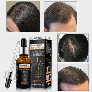 Olio <span class=keywords><strong>per</strong></span> la Crescita dei <span class=keywords><strong>Capelli</strong></span> con Formula Naturale, Etichetta Privata Personalizzata, Siero Nutriente <span class=keywords><strong>per</strong></span> il Cuoio Capelluto, Olio Organico <span class=keywords><strong>per</strong></span> Rapido Infoltimento dei <span class=keywords><strong>Capelli</strong></span> - Product Image 5