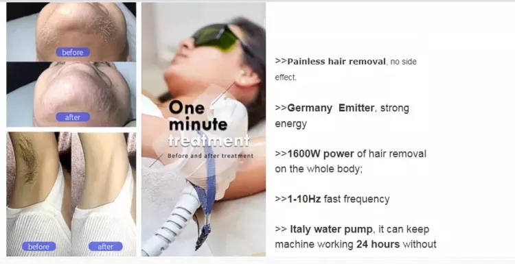 Stand 2 in 808nm diode hair removal and nd yag laser tattoo removal machine