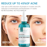 Sérum Ultra Traitant Anti-Acné pour le Visage, Sérum Anti-Acné à la Niacinamide avec Acide Glycolique 1,5% et Acide Salicylique