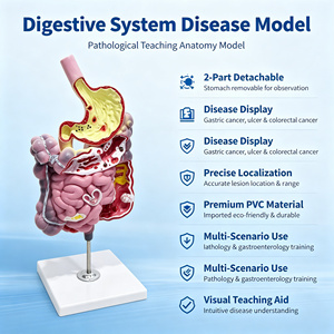 Modelo <span class=keywords><strong>de</strong></span> Enfermedad del Sistema Digestivo <span class=keywords><strong>de</strong></span> PVC, 2 Partes Desmontables, Estómago para Enseñanza <span class=keywords><strong>de</strong></span> Patología, CE ISO ROHS CNAS - Product Image 1