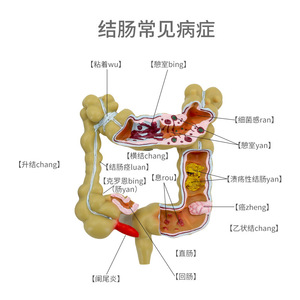 Modelos patológicos de intestino grueso, modelo de colon pequeño, modelo de lesiones del intestino grueso, enfermedades intestinales, modelo de lesiones del colon - Product Image 1