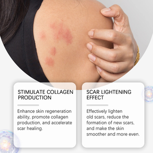 Crema de Silicona para Cicatrices 50g, Marca Privada OEM, Grado Médico, Aplana y Desvanece Cicatrices Queloides, Quemaduras y Quirúrgicas - Product Image 5