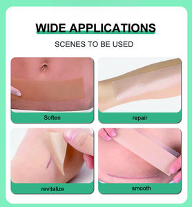Hojas de cicatriz de silicona Cinta de cicatriz de silicona reutilizable para cesárea Queloide Bump Estrías Quemadura Tummy Tuck Eliminación de cicatrices quirúrgicas - Product Image 3