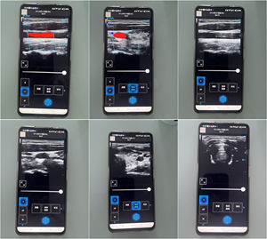 SUN-D7 128 éléments diagnostic vétérinaire sonde sans fil à ultrasons Doppler couleur - Product Image 2