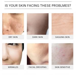 MRUIS Bio Plante Apaisant Éclaircissant Visage Essence Hydratant Rougeurs Sérum Apaisant Éclatant Peaux Sensibles Vente en Gros - Product Image 6