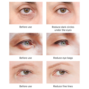 ครีมบำรุงรอบ<span class=keywords><strong>ดวงตา</strong></span> OEM/ODM ลดเลือนริ้วรอย <span class=keywords><strong>ยก</strong></span><span class=keywords><strong>กระชับ</strong></span>ผิว ลดรอยคล้ำใต้ตา สำหรับการดูแลรอบ<span class=keywords><strong>ดวงตา</strong></span>ต่อต้านริ้วรอยทุกวัน - Product Image 5