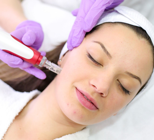 Sérum éclat Mesowhite de haute qualité de marque privée pour éclaircir la peau blanchissant le kit de fond de teint <span class=keywords><strong>BB</strong></span> - Product Image 6