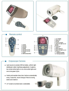 AMAIN Draagbare Digitale Video <span class=keywords><strong>Vagina</strong></span> Colposcoop Colposcopie Gynaecologisch Onderzoek - Product Image 6