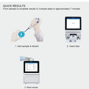 MNCHIP V5 Dry Chemistry Analyzer Dry Hematology Analyzer Veterinary Mnchip V5 Automatic Biochemical Analyzer - Product Image 5