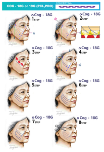 D Medikal Emilebilir Yüz Germe 21g 100mm <span class=keywords><strong>Pdo</strong></span> <span class=keywords><strong>6d</strong></span> Cog İplikleri L Kör Uçlu - Product Image 2