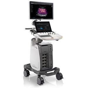 Système d'échographie Doppler couleur Sonoscape P60 sur chariot, élastographie haute définition multi-usages pour la médecine vétérinaire - Product Image 6