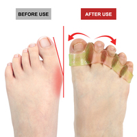 Séparateur d'orteils pour yoga, correcteur d'hallux valgus, soulagement de la douleur, outil de pédicure, soin des pieds, coloré, en SEBS, à 5 trous, pour femmes