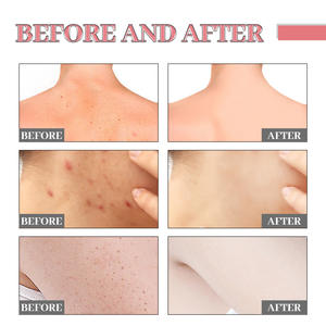 Soins de la peau végan et bio Savon exfoliant blanchissant en forme de cœur pour adultes Barre exfoliante de nettoyage de la peau - Product Image 4