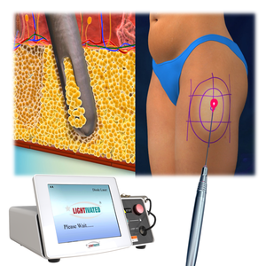 2025 <span class=keywords><strong>precio</strong></span> de fábrica mínimamente invasivo 1470nm diodo estiramiento facial pérdida de peso Endolifting máquina de <span class=keywords><strong>liposucción</strong></span> láser Facelift - Product Image 1