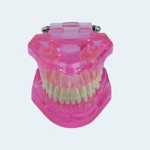 Modèle pédagogique en plastique pour la démonstration des pathologies dentaires : caries, kyste apical, tartre, implant, impaction, etc. - Product Image 2