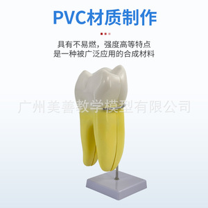 Modelo de dientes incisivos, caninos y molares humanos ampliados 12 veces; herramienta didáctica para el desmontaje anatómico de la pulpa dental y el nervio. - Product Image 2