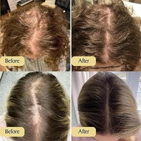Natürliches Pflanzen-Haaröl für Dickeres, Volleres Haar 60ml Reines Haarwuchsöl Stimuliert Follikel Rosmarin-Arganöl Kopfhautpflege