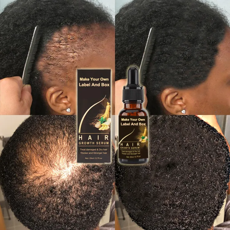 Tratamiento para el cuidado del cabello con Logo personalizado, Alisador, reparador, antipérdida, crecimiento del cuero cabelludo, suero de aceite para el crecimiento del cabello