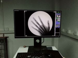 Thú Y c-cánh tay hình ảnh khuếch C cánh tay <span class=keywords><strong>x</strong></span> Ray giá - Product Image 6