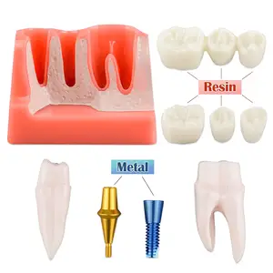 Modelo de implante Dental para educación de pacientes, corona y puente de implante Dental para presentación, 4 veces, Rosa