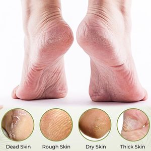 Double-Sided Wooden Handle Foot File & Scrubber Pedicure Tool with Eco-Friendly Design for Removing Dead Skin and Calluses - Product Image 3