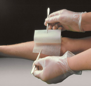 ONEMED Compresses de gaze stériles paraffinées chirurgicales, Pansements de gaze paraffinée, Bandages de gaze à la vaseline - Product Image 2