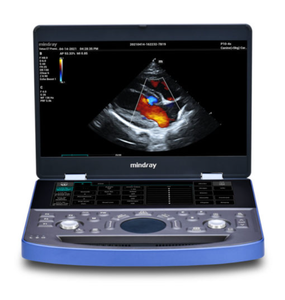 Ecógrafo Médico Portátil Mindray Vetus E7, Certificado CE Clase II, Construcción Metálica, 1 Año de Garantía, Fuente de Alimentación Enchufable - Product Image 1