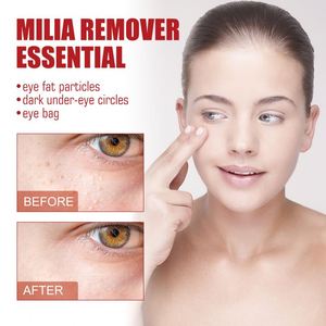 Sérum pour les yeux South Moon 30 ml, logo personnalisé, élimination des particules graisseuses et des poches sous les yeux en 1 semaine, éliminateur de <span class=keywords><strong>milia</strong></span> lunaire, essentiel - Product Image 2